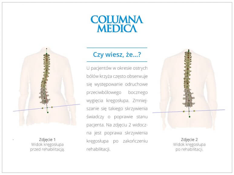Columna Medica_zdj.1.